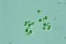 Chroococcus