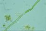 Oedogonium