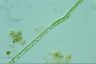 Oedogonium