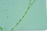 Stigeoclonium