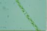 Spirogyra