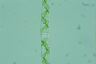 Spirogyra