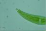 Closterium moniliferum