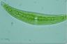 Closterium moniliferum