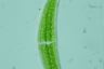 Closterium moniliferum