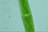 Closterium rostratum