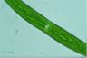 Closterium intermedium