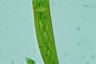 Closterium costatum