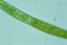 Closterium intermedium