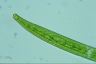 Closterium intermedium