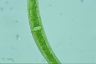 Closterium nematodes