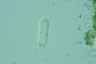 Tetmemorus brebissonii