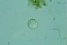 Acanthocystis