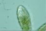 Euglypha brachiata