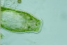 Microdalyllia