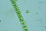 Peroniella hyalothecae