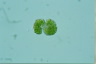 Botryococcus braunii