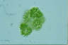 Botryococcus sudetica