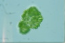 Botryococcus sudetica