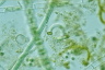 Ophiocytium bicuspidatum