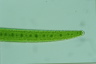 Closterium turgidum