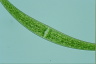 Closterium nematodes