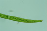 Closterium intermedium