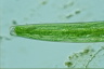 Closterium baillyanum