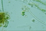Staurastrum apiculatum