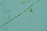 Staurastrum polymorphum