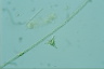 Staurastrum polymorphum