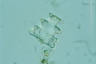 Euastrum pinnatum