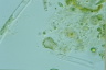 Difflugia globulosa
