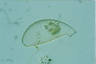 Cyphoderia ampulla