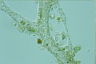 Leptomyxa