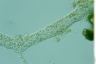 Leptomyxa