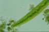 Closterium baillyanum