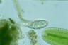Hyalosphenia elegans