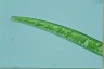 Closterium intermedium