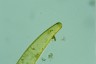 Closterium baillyanum