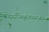 Microspora pachyderma