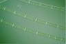 Spirogyra