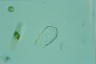 Sphenoderia fissirostris