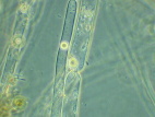 Leptomitus lacteus