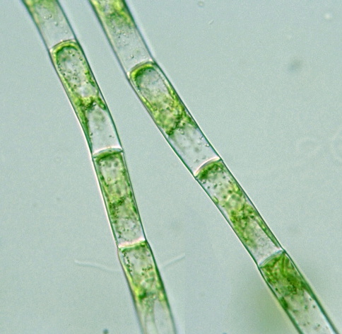 http://protist.i.hosei.ac.jp/pdb/Images/Chlorophyta/Filamentous_algae/sp_9e.jpg