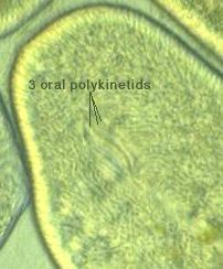 Frontonia leucas oral polykinetids