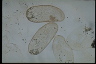 Paramecium trichium