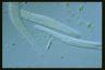 Spirostomum teres