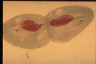 Paramecium caudatum, cell division