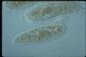 Paramecium caudatum, macronuclear inclusion body